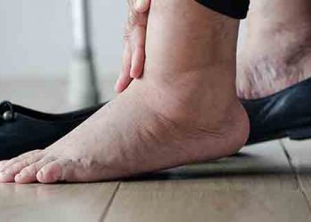 The most common aging foot issues are those an effect on the skin,  joints, nails, and blood circulation.