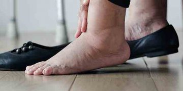 The most common aging foot issues are those an effect on the skin,  joints, nails, and blood circulation.